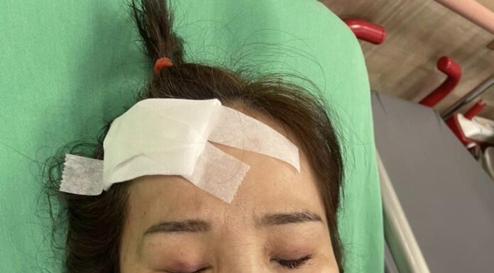 候選人遭毆 法務部、內政部:絕不容暴力妨害選舉